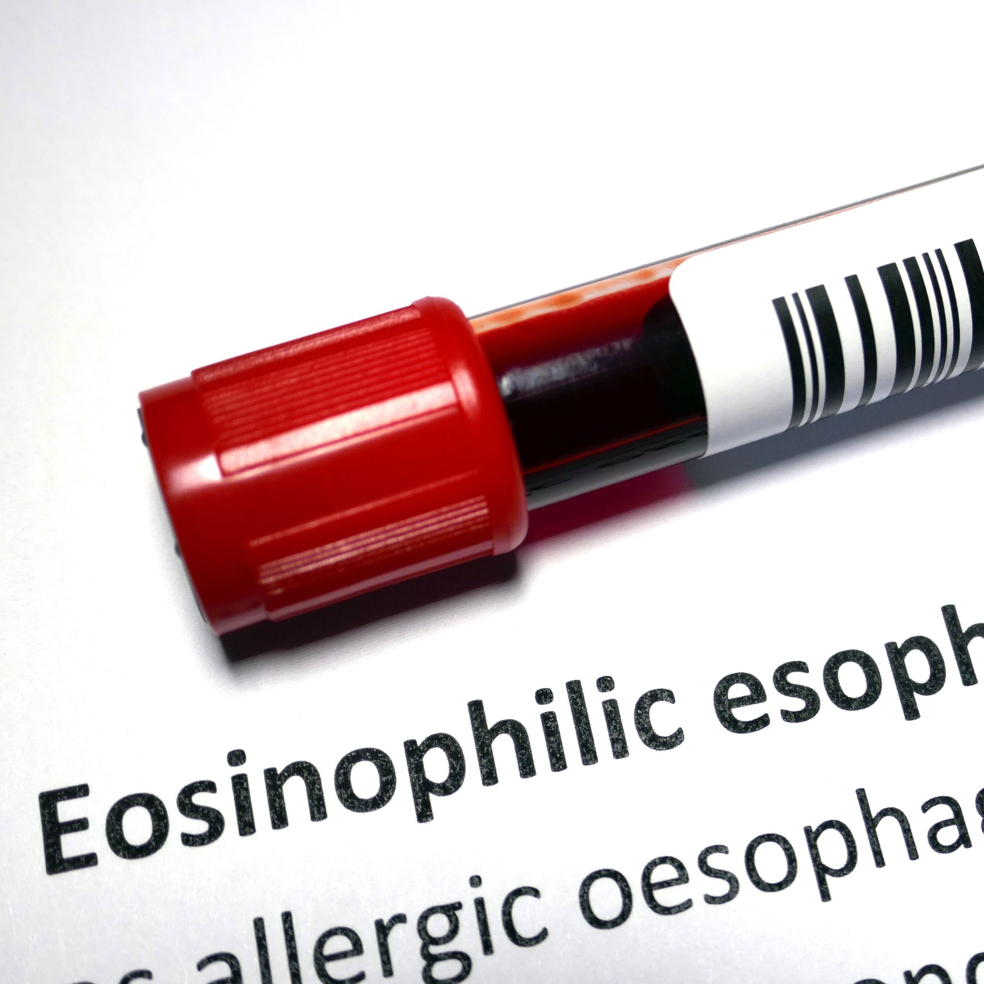 EoE diagnosis