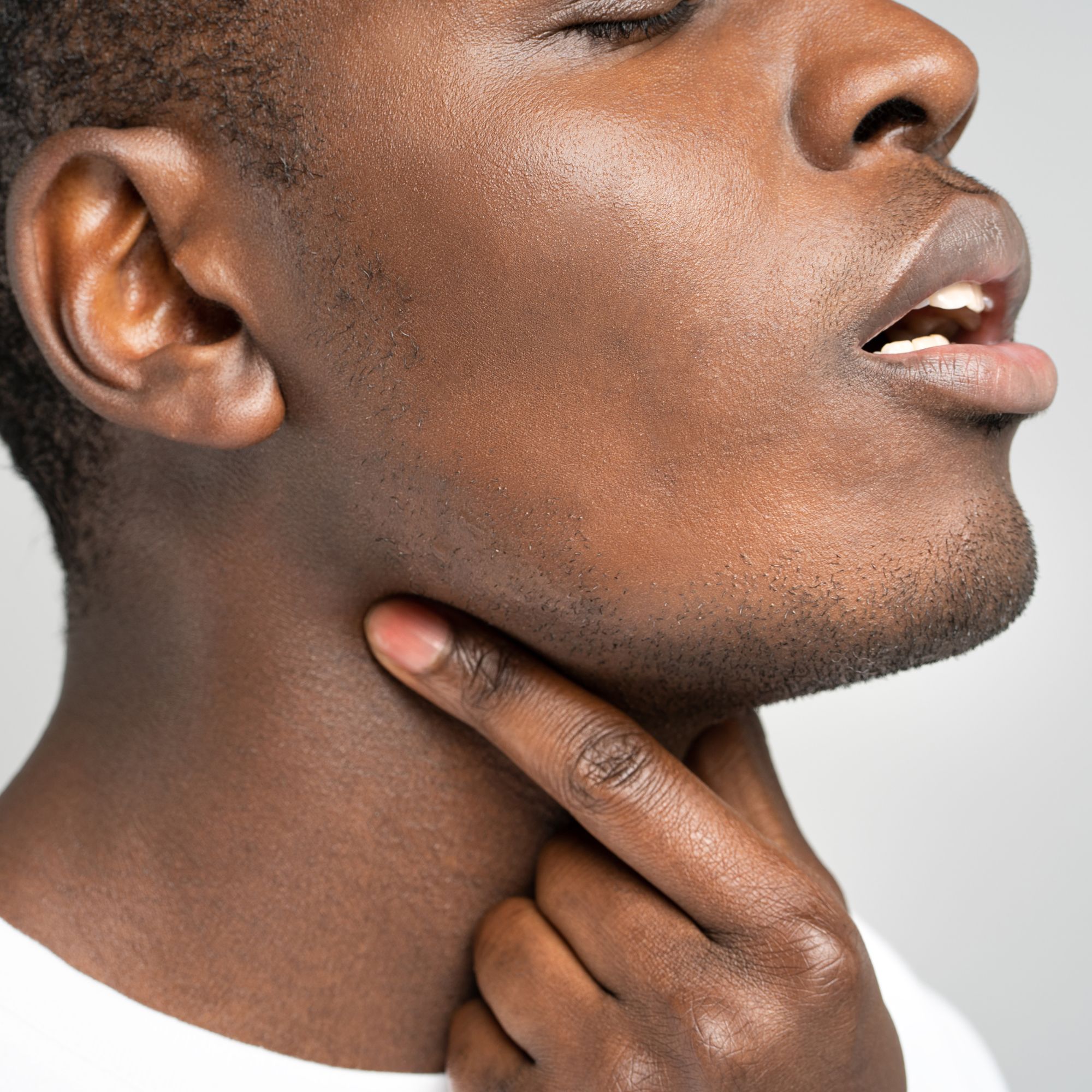 Eosinophilic Esophagitis Symptoms
